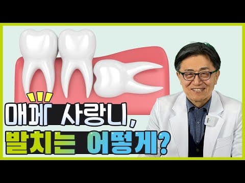 매복사랑니 , 발치는 어떻게 ?