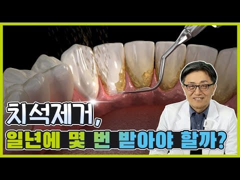 치석제거 , 일 년에 몇 번 받아야 할까 ?