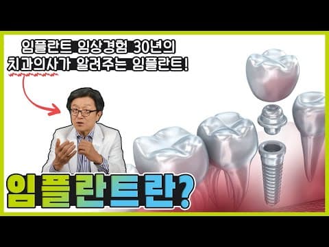 [임플란트 1탄] 임플란트란 ?